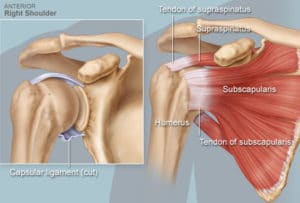 torn rotator cuff test