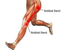 Leg muscle diagram