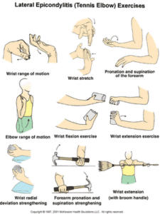 Tennis elbow exercises
