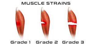muscle strain diagram