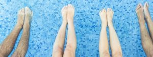 Legs view of friends relaxing and chilling in swimming pool showing different lengths in legs that may cause back pain