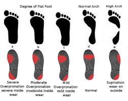 Choose the right footwear for foot pain