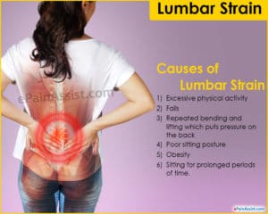 Causes of lumbar strain