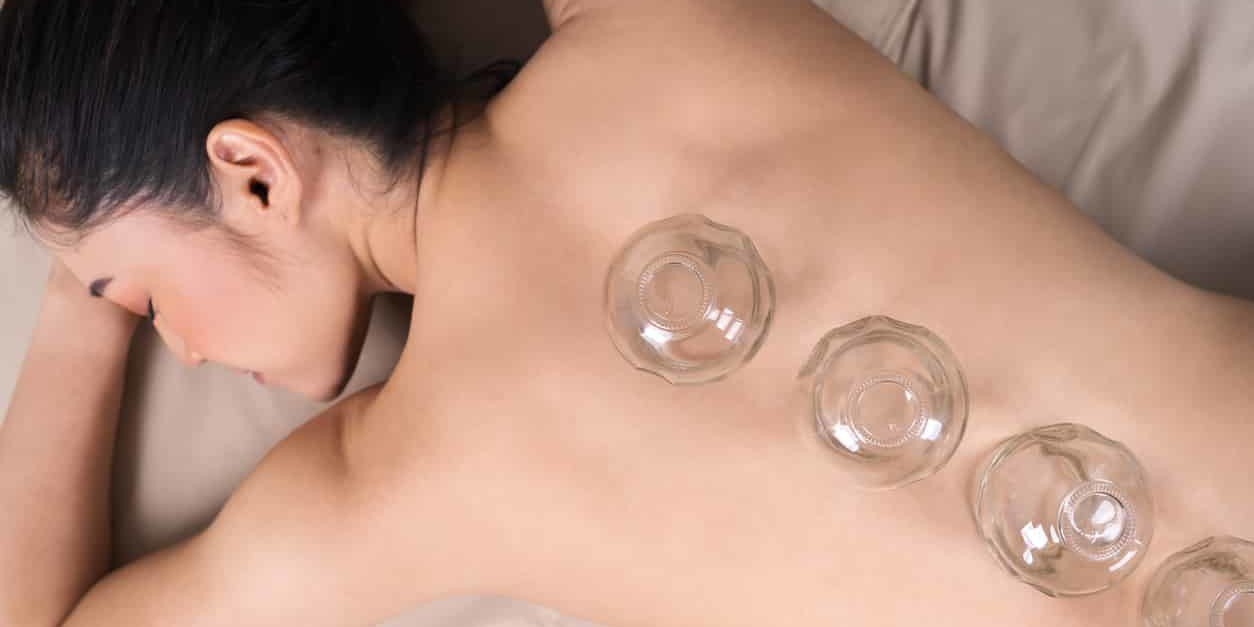 A young woman relaxing while getting cupping therapy on her back